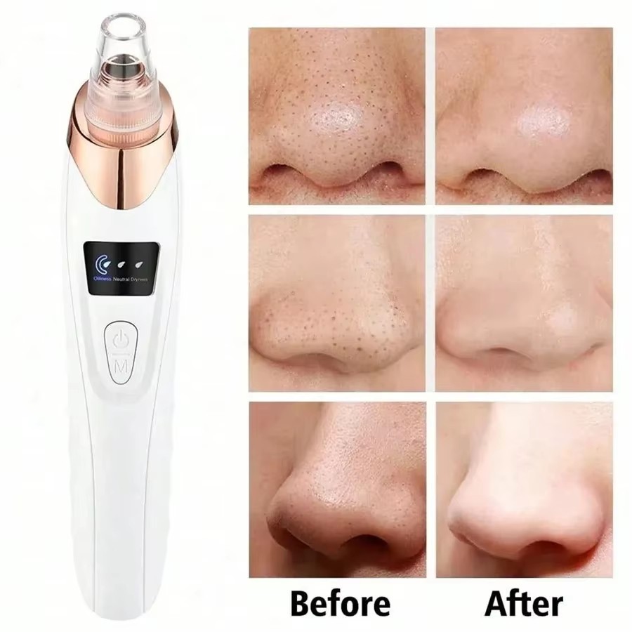 Electric Blackhead Remover Vacuum 5 Suction Pore Cleanser