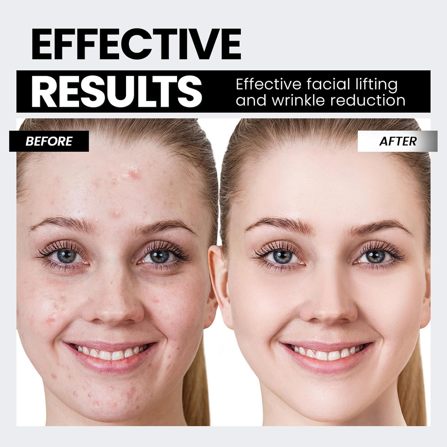 Microcurrent Facial Device,Latest Red Light Technology，Enhances the Ability to L