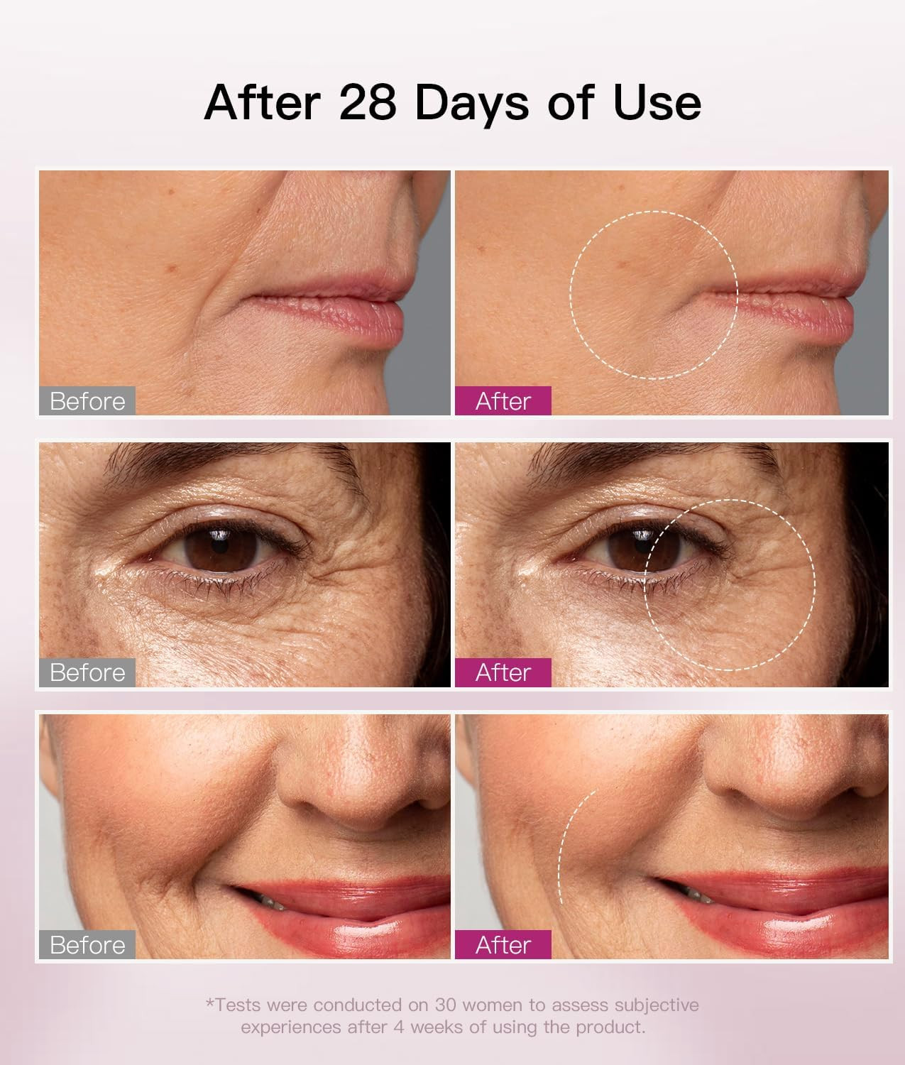 Microcurrent Facial Device, Face Sculpting Tool for Instant Lift &Amp; Contour,