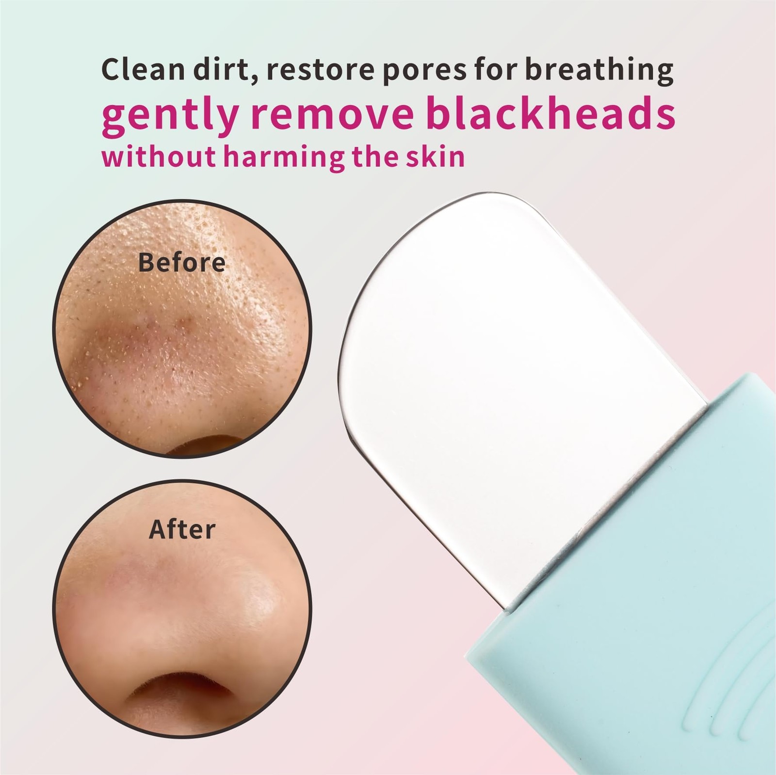 REVEX Silicone Nose Blackhead Remover Tool Set,Blackhead Pink and Mint Green