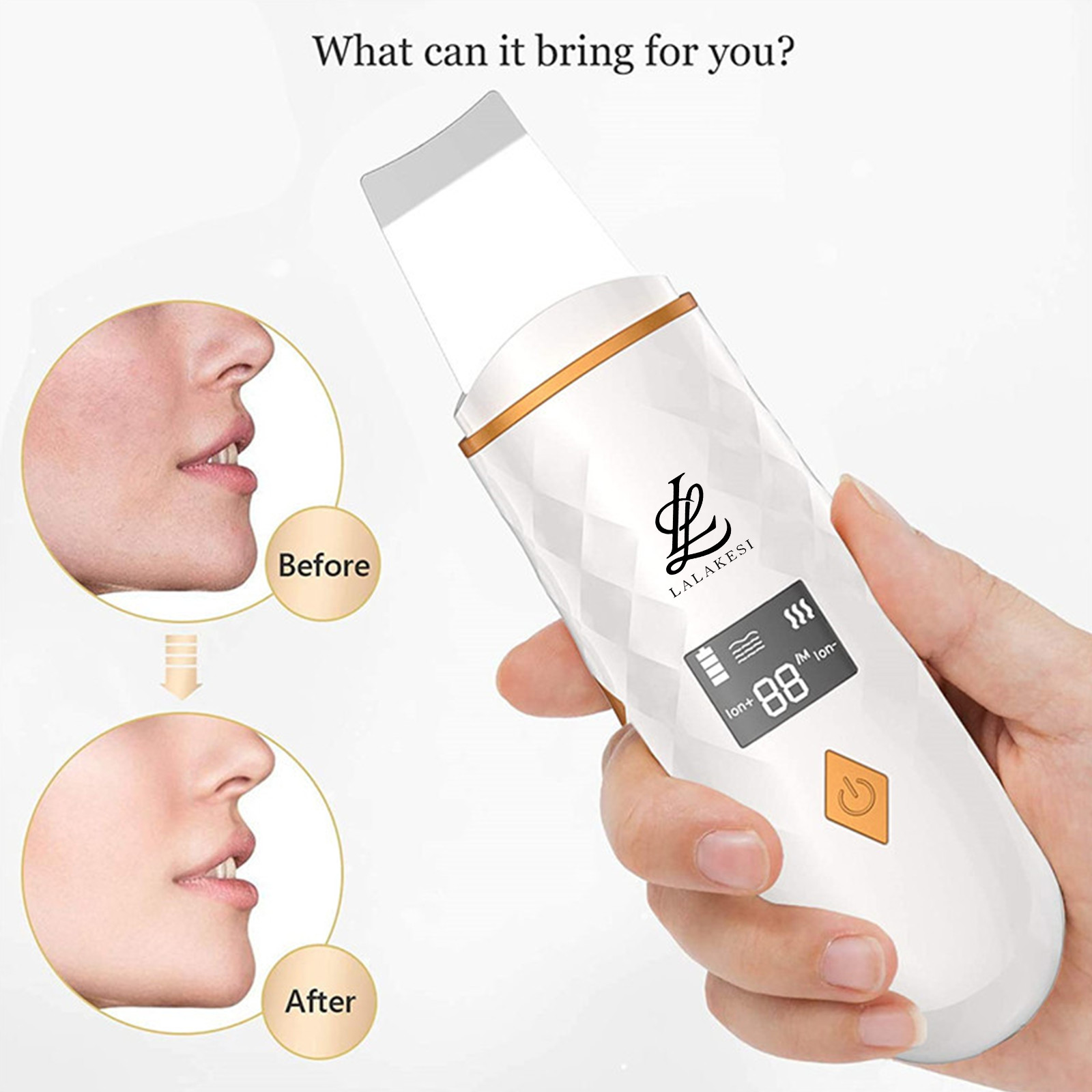 LL LALAKESI Ultrasonic Facial Cleansing Instrument Ion Beauty Instrument