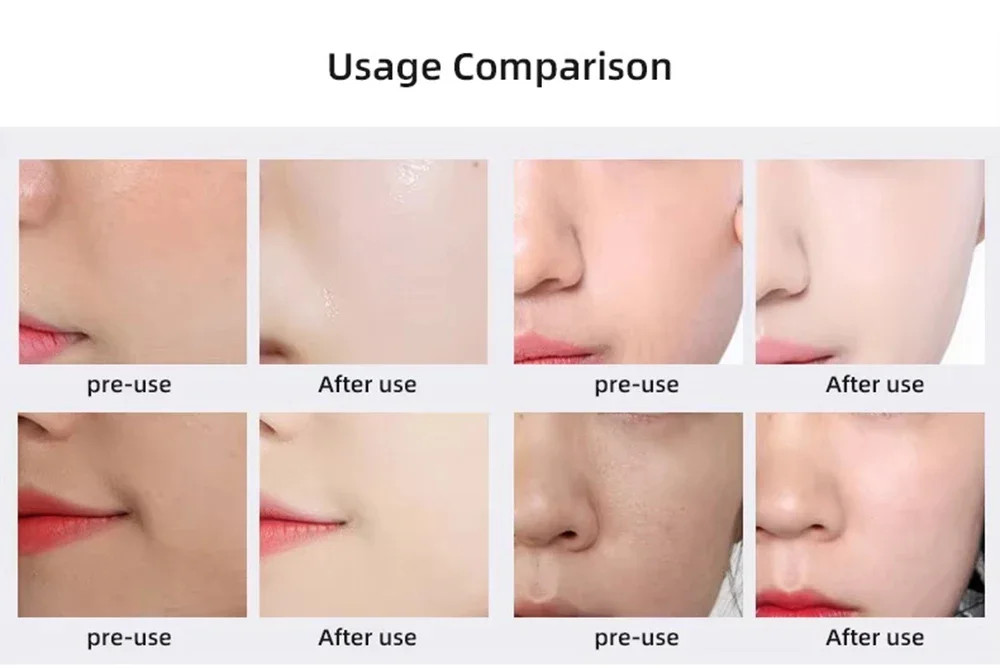 New CO2 Oxygen Bubble Device Exfoliate Oxygen Facial Machine Wrinkle Removal
