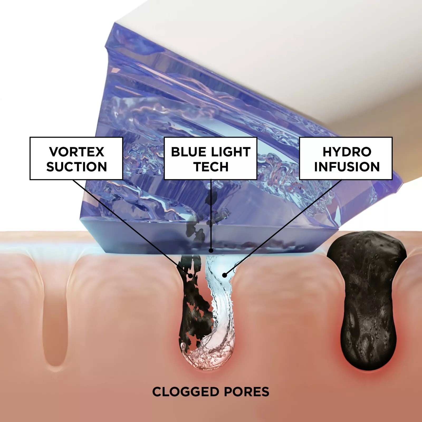 BeautyBio GLOfacial Hydro-Infusion Pore Cleansing Tool +Blue LED Clarifying Tool