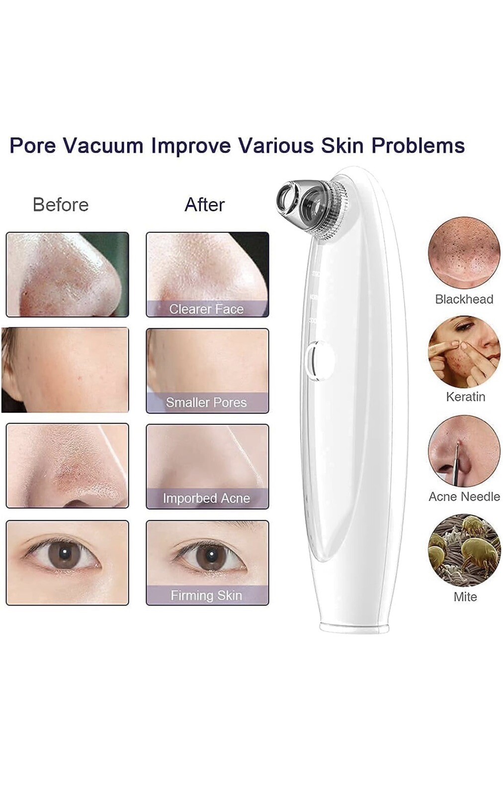 Pore Vacuum Blackhead remover with camera,LeveTop visible facial pimple…
