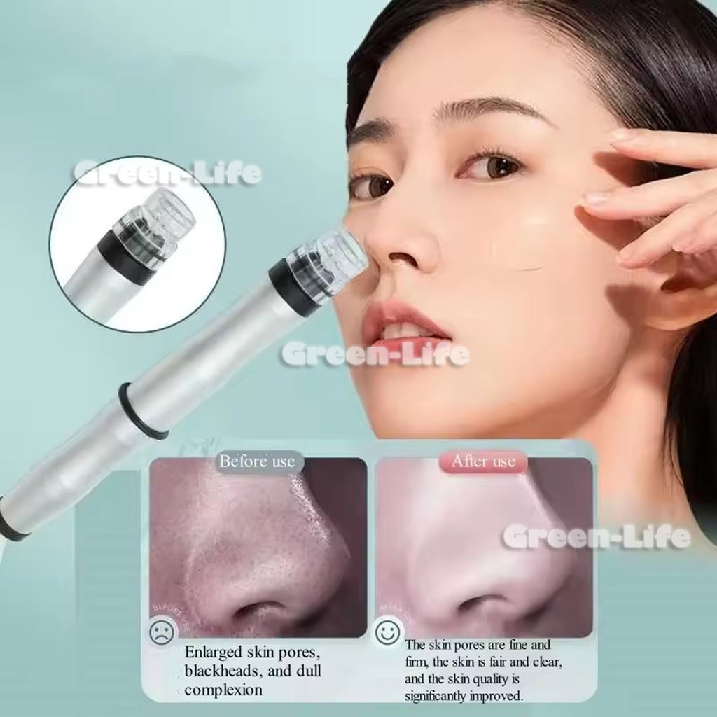 Face Small Bubble Cleaning Blackhead Acne Device Oxygen Bubble Machine Care Skin