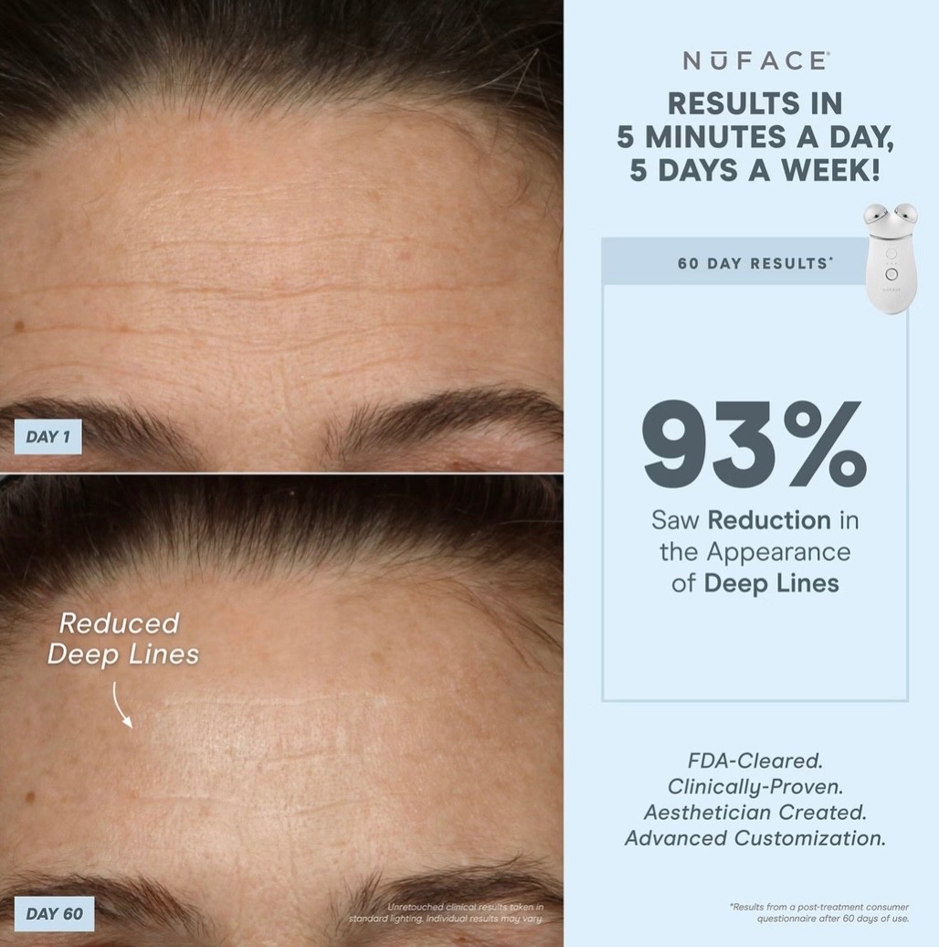 NuFACE Trinity+ Facial Toning Firming Lifting Device Kit w Super Peptide Booster