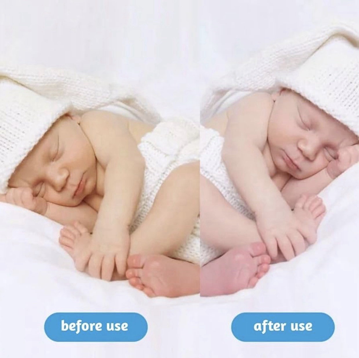 Newborn Baby Jaundice Blue Ray Light Therapy 144LED Blue Lamp Box 460nm