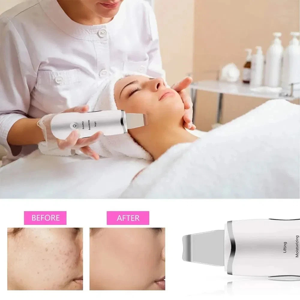 3-in-1 Ultrasonic Facial Spatula for Deep Cleansing, Electric Ultrasonic Skin Sc