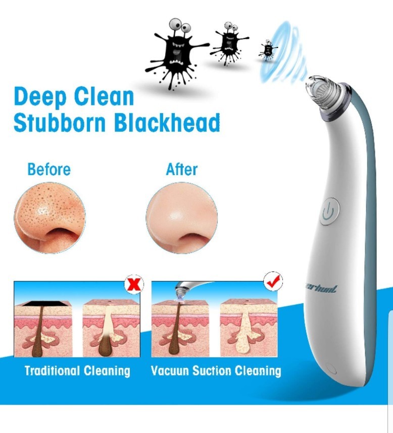 Blackhead Remover Pore Vacuum Cleaner Electric Pore Cleaner Removal Blackhead…