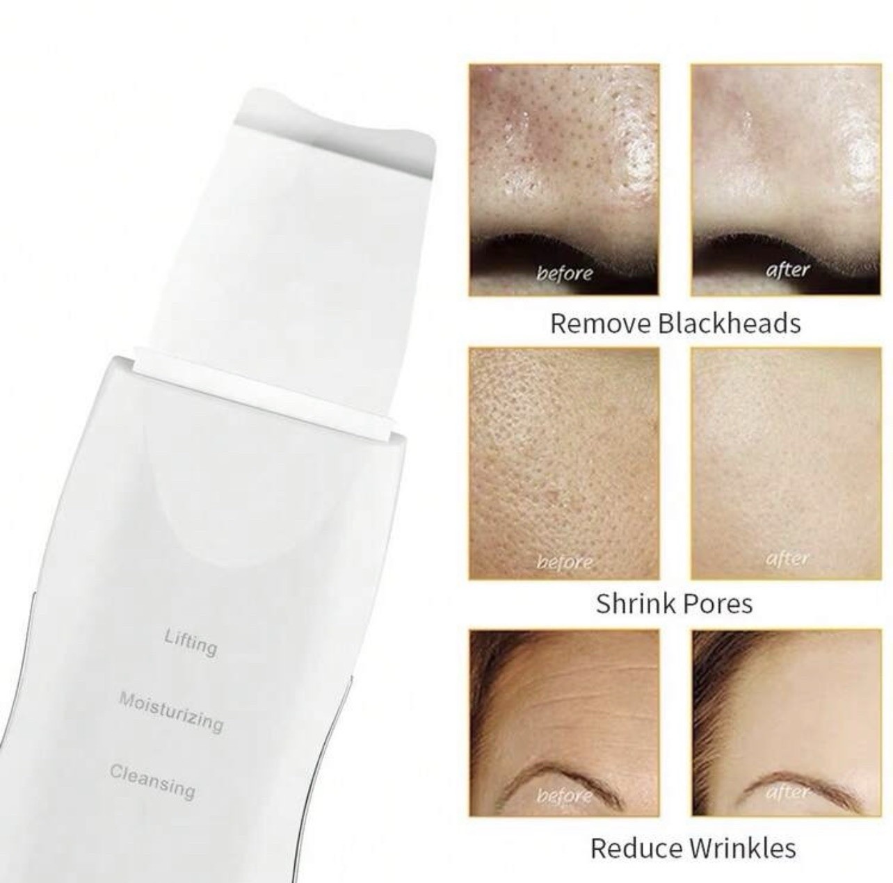 Rechargeable Face Scrubber Spatula, Facial Pore Cleaner, Black Head Remover