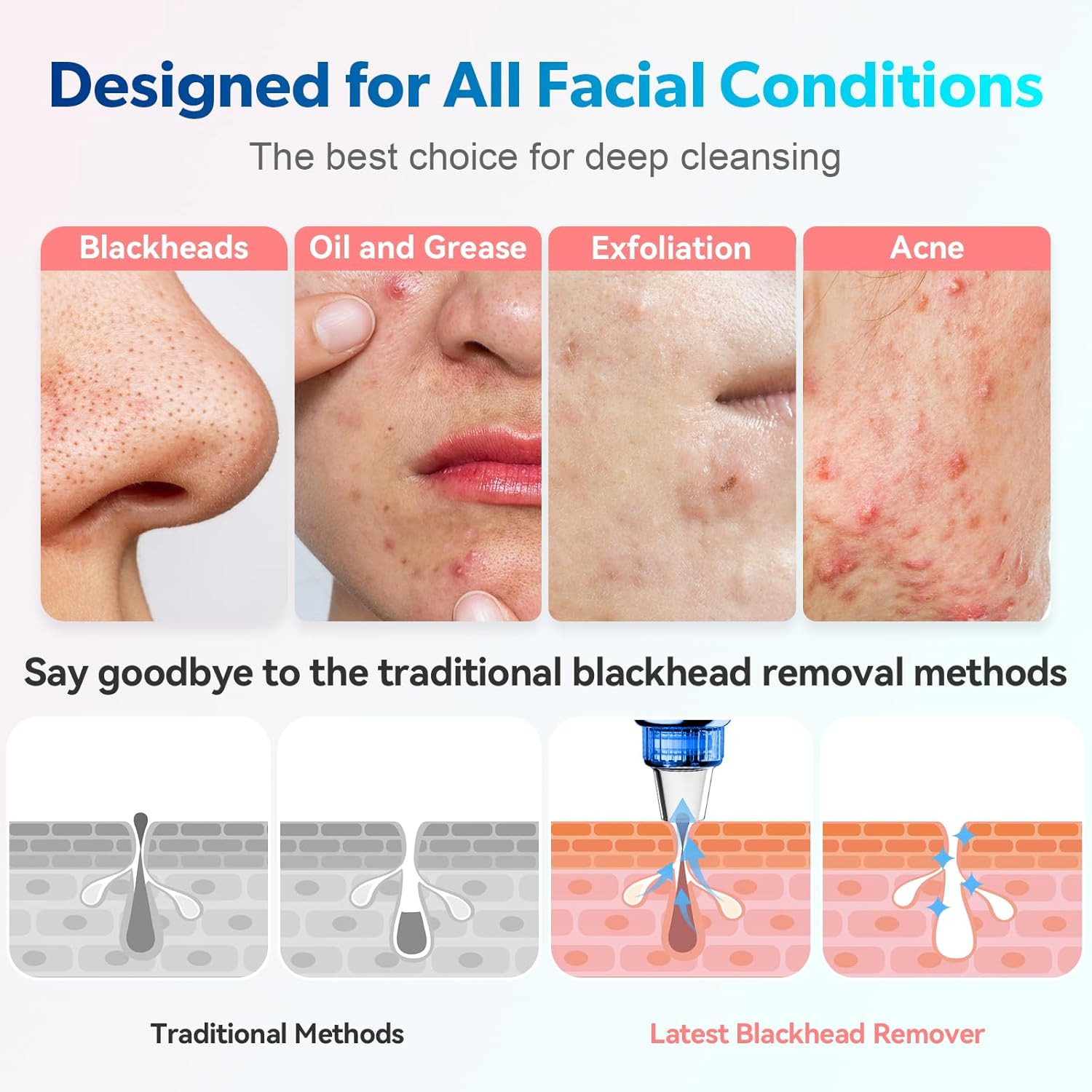 Blackhead Remover Pore Vacuum Upgraded Facial Pore Cleaner Electric Comedone Whi
