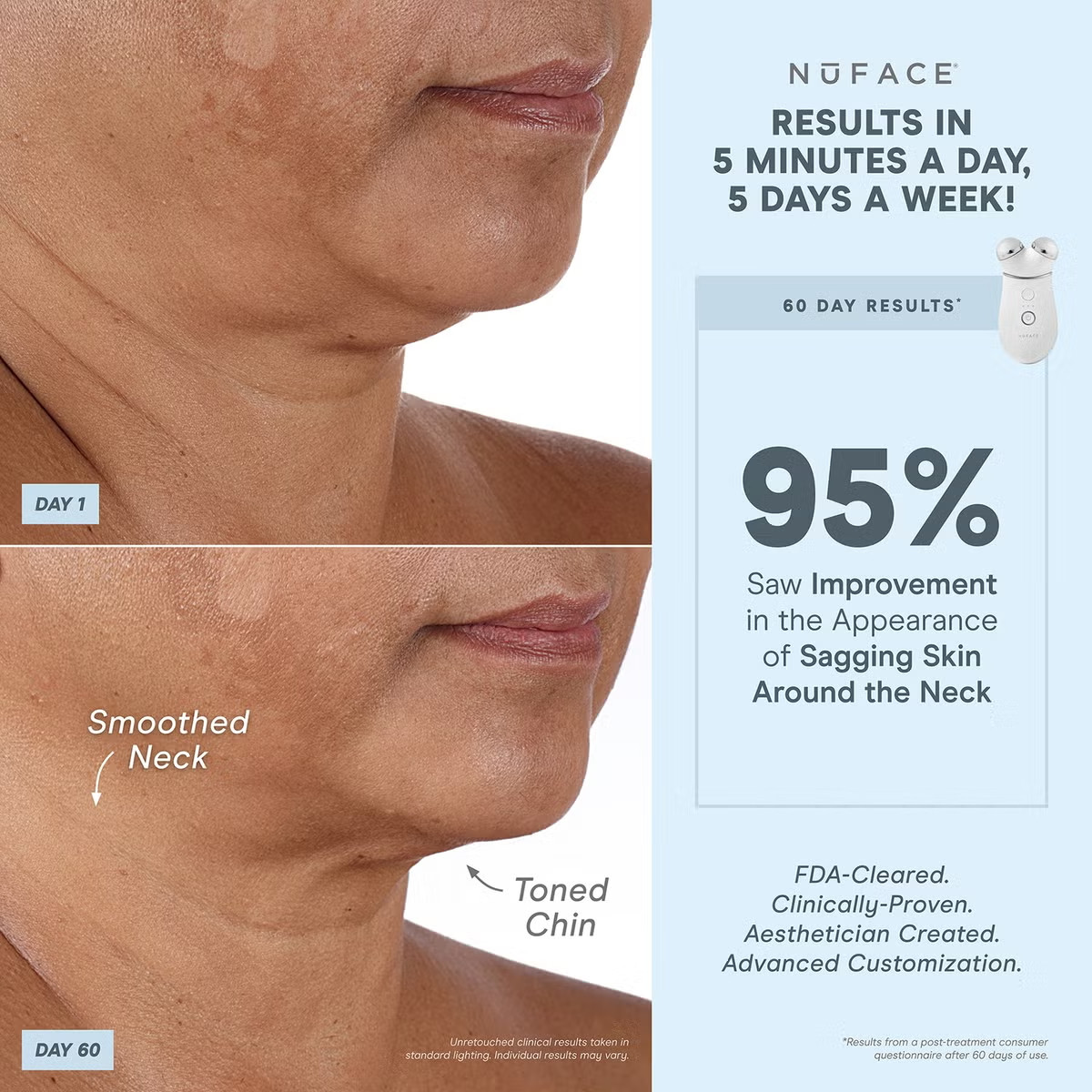 NuFACE TRINITY+ Advance Facial Toning Device + Charging Base