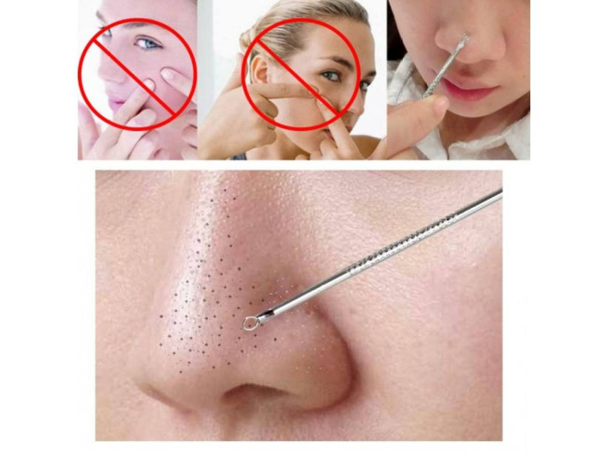 Black Heads Pimples Acne Needle Tool Blackheads Comedone Acne Blemish Extractor