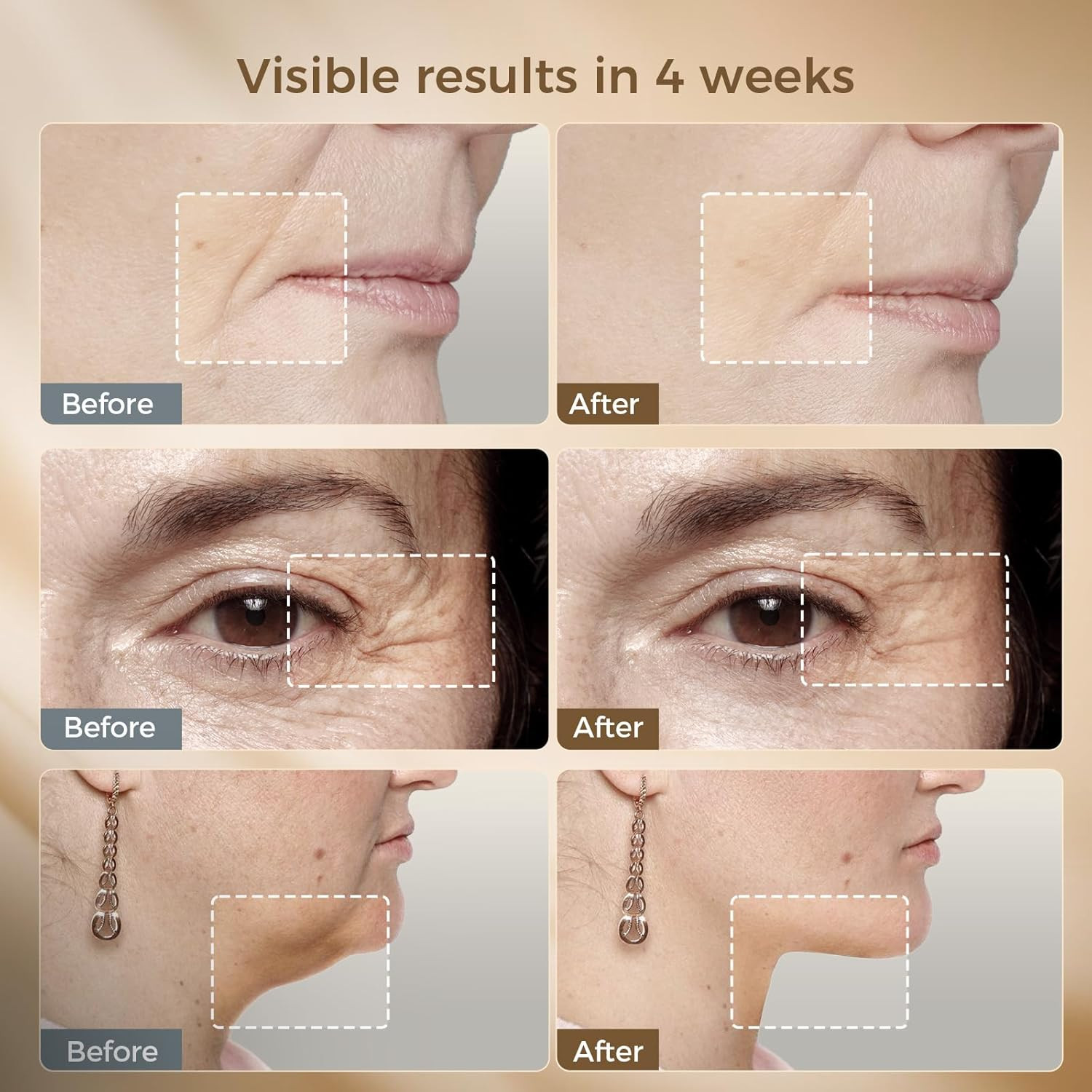 Microcurrent Facial Device with Red Light Therapy, Cooling Skin Tightening Devic