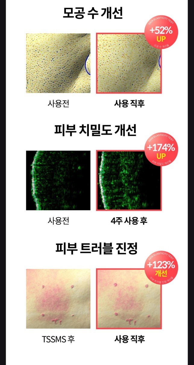 [nuzz] nuzz one standard / one shot elastic device / Facial Skin Care Device