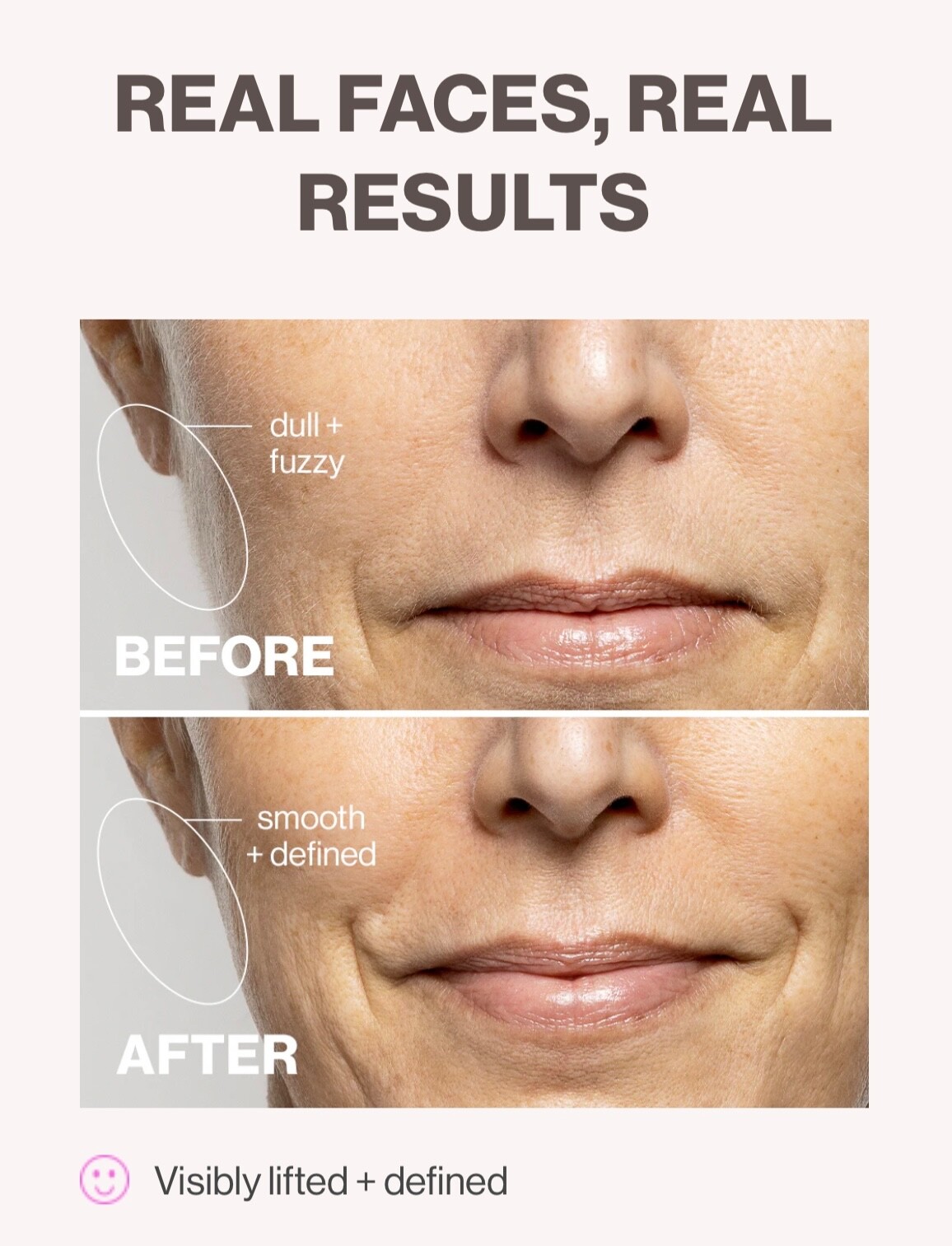 DERMAFLASH LUXE HAIR REMOVAL SYSTEM + EXTRAS RT. $309! *Anti-aging, too!* NIB 👍