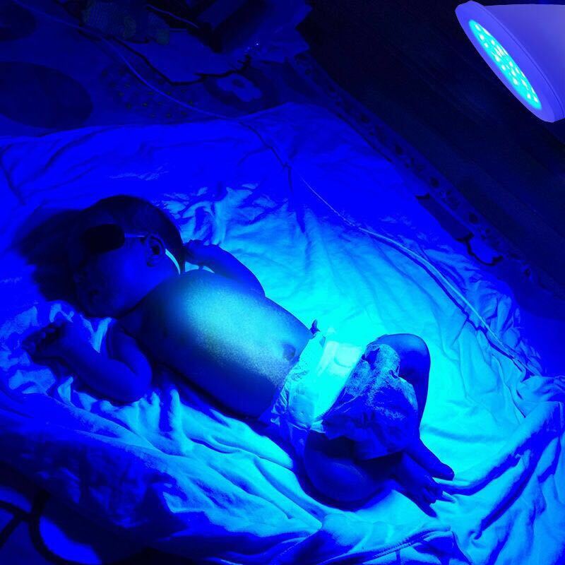 Neonatal jaundice blue light baby blue light baby jaundice blue light