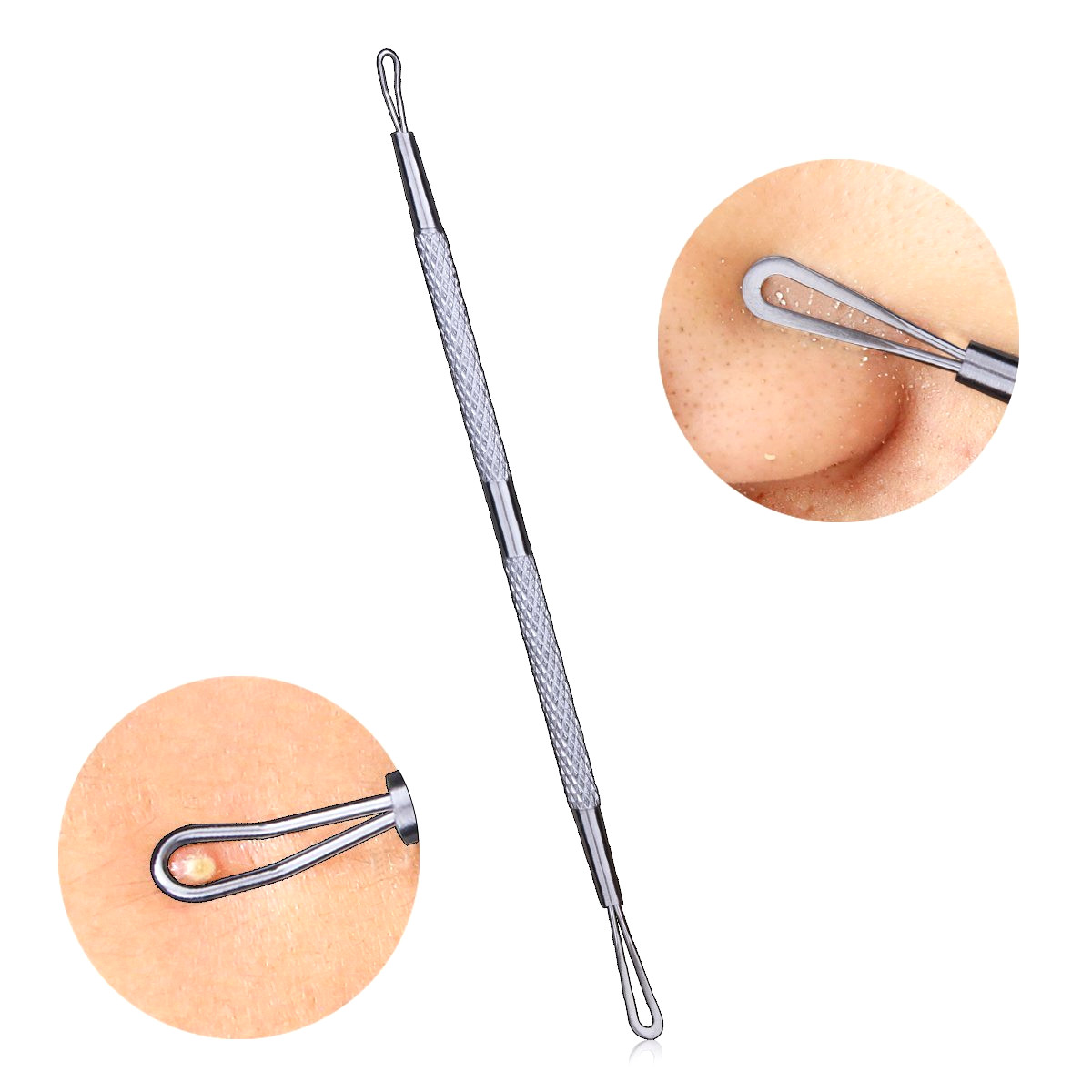Blackhead Remover Tools Kit (6 Pcs) Pimple Comedone Acne Blemishes Extractor Set