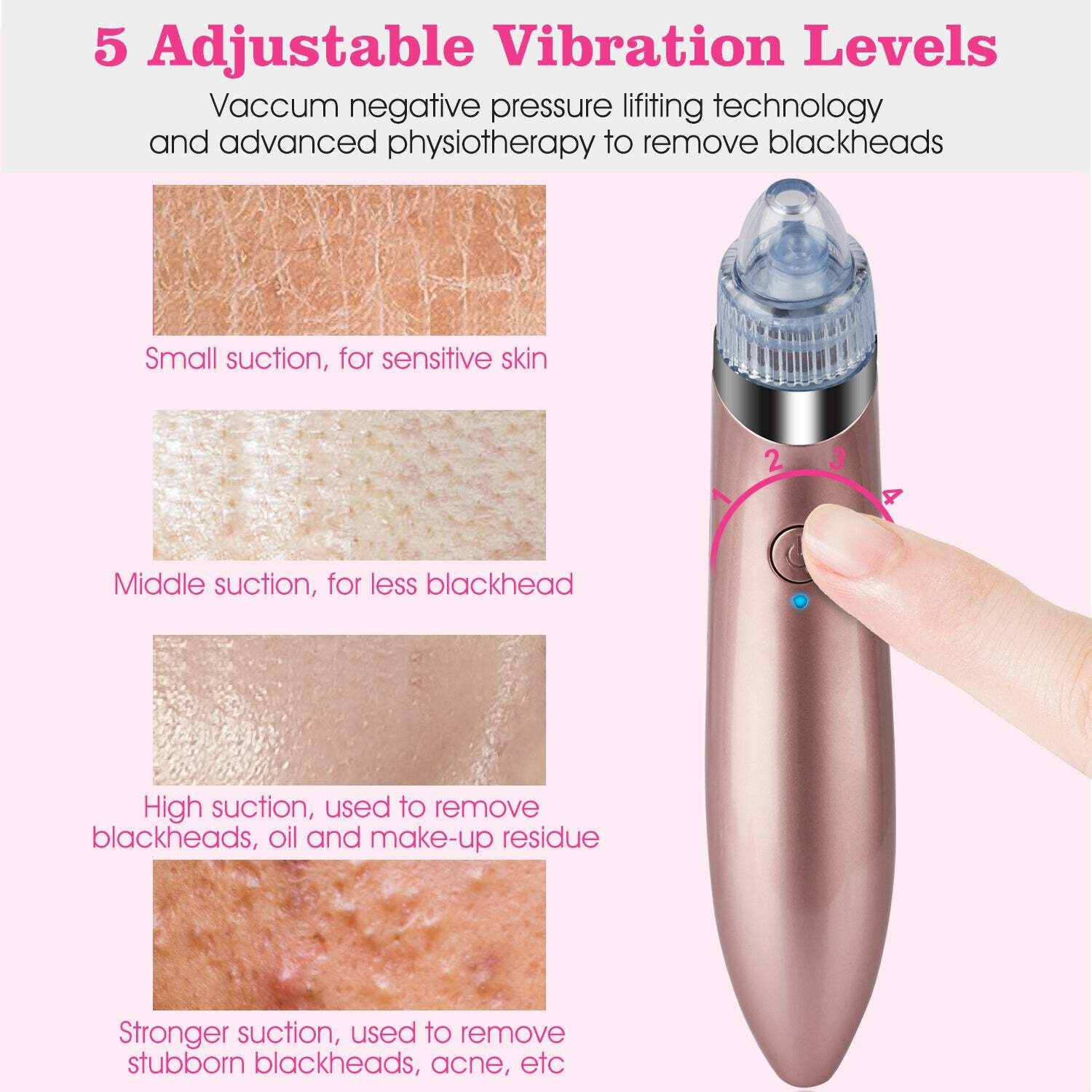 Electric Blackhead Remover Vacuum Suction Facial Pore Cleaner Acne Pimple Extrac