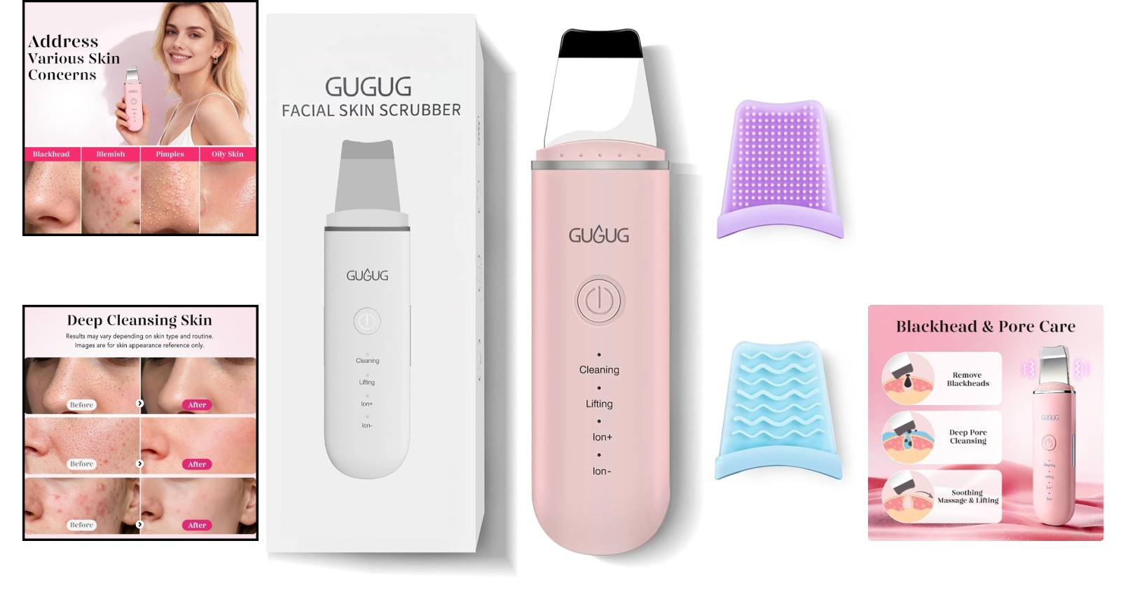 Rechargeable Stainless Steel Skin Scrubber: Ultimate Blackhead Remover & Cleaner
