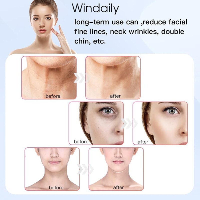 Face Neck Lifting Device Vibration EMS Facial Massager LED Light Therapy Machine