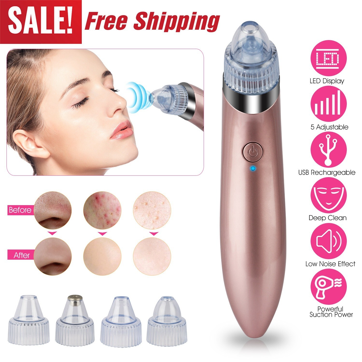 New Electric Blackhead Remover Vacuum – Facial Pore Cleaner Acne Extractor