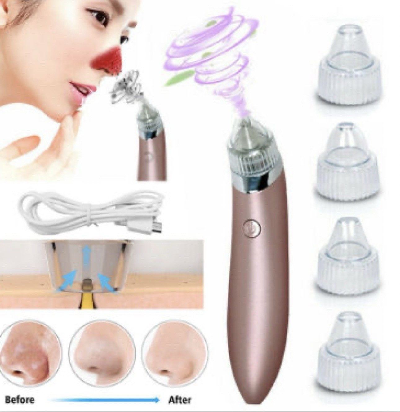 Electric Blackhead Remover – Facial Pore Cleaner Skincare USB Tool
